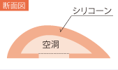 断面図